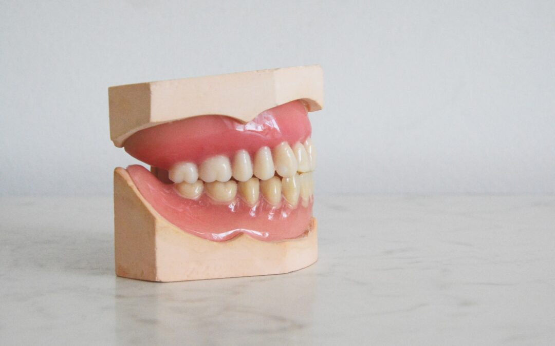Are Implant Dentures Better than Regular Dentures?